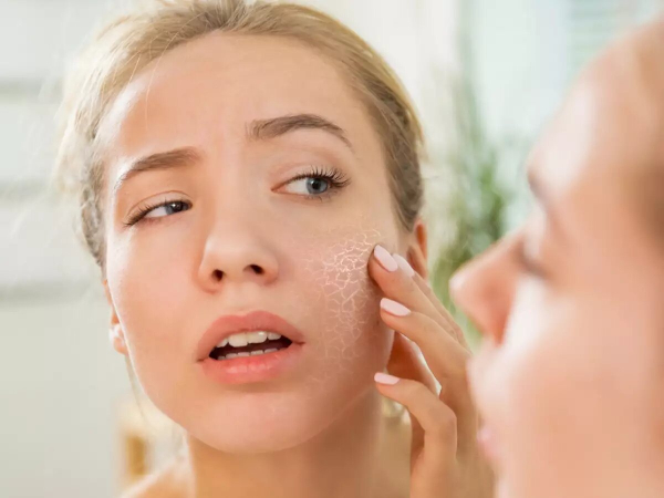 Dry skin needing hydration